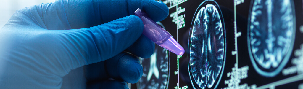 Understanding Pharmacodynamics Is The Study Of The Mechanism Of