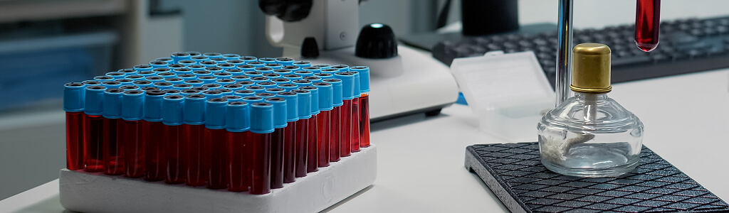 Understanding Biotech Product Development Firm Challenges