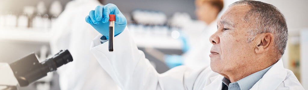 Comprehensive Insights Into Biomarker Discovery Services